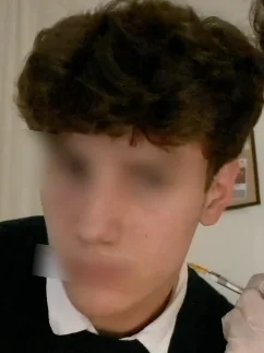 Orka mid-procedure, face blurred, a gloved hand holding a needle at the cheek